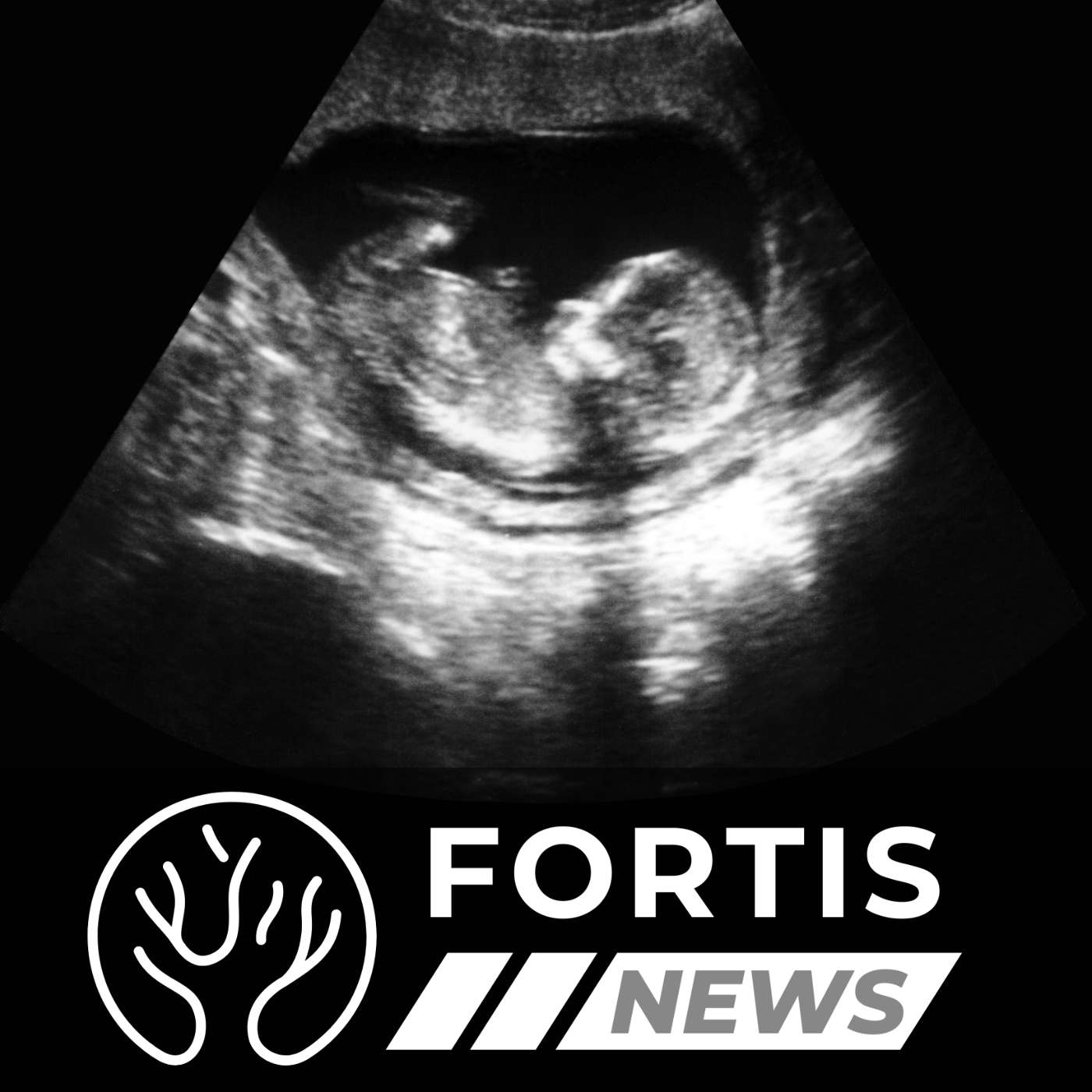 UNBORN CHILDREN GET RECOGNITION & $200B FLOWS OVERSEAS